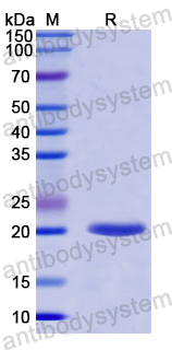 Recombinant Human PTGDS Protein, N-His