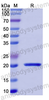 Recombinant Human GARS1 Protein, N-His