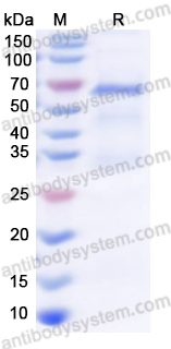 Recombinant Human IARS1 Protein, N-His