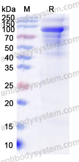 Recombinant Human IARS1 Protein, N-His