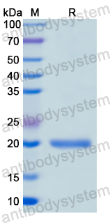 Recombinant Human NBL1 Protein, N-His