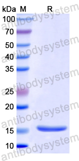 Recombinant Human SLC19A1 Protein, N-His