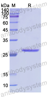 Recombinant Human PRKCI Protein, N-His