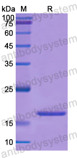 Recombinant Human ECI1 Protein, N-His