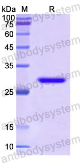 Recombinant Human TMPO Protein, N-His