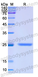 Recombinant Human PIK3CB/p110beta Protein, N-His
