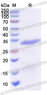 Recombinant Human CASP3/Caspase-3 Protein, N-His