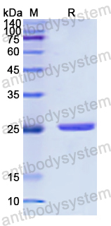 Recombinant Human DPP6 Protein, N-His