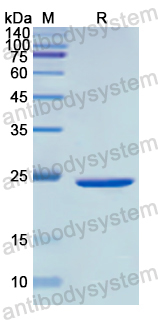 Recombinant Human CD212/IL12RB1 Protein, N-His