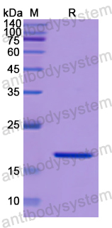 Recombinant Human CD118/LIFR Protein, N-His