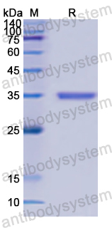 Recombinant Human ACAA2 Protein, N-His