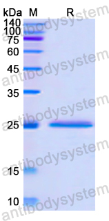 Recombinant Human WAS Protein, N-His