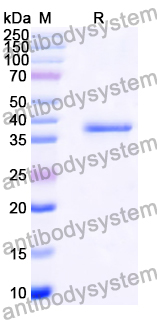 Recombinant Human WAS Protein, N-GST & C-His