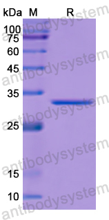 Recombinant Human PRCP Protein, N-His