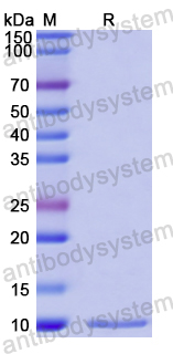 Recombinant Human CXCL5/ENA-78 Protein, N-His