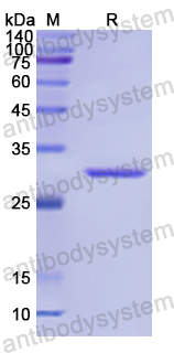 Recombinant Human ECE1 Protein, N-His