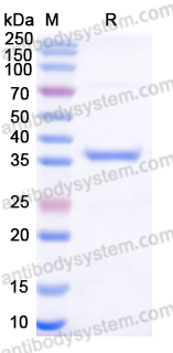 Recombinant Human MTHFR Protein, N-His