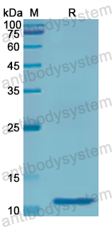 Recombinant Human SLC1A1 Protein, N-His