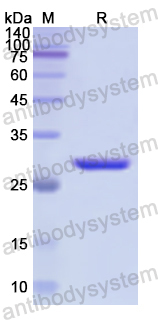 Recombinant Human CD146/MCAM Protein, N-His