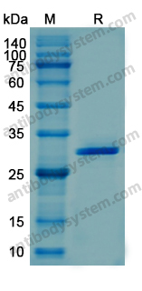 Recombinant Human CTSK Protein, N-His