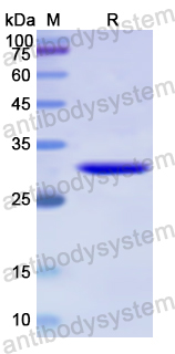 Recombinant Human GRK6 Protein, N-His