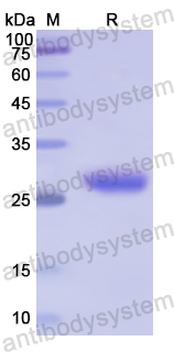 Recombinant Human BTD Protein, N-His