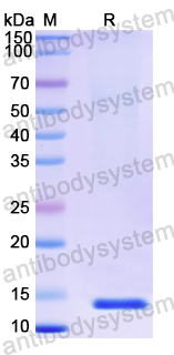 Recombinant Human SSR2 Protein, N-His