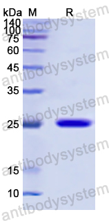 Recombinant Human CRYBB2 Protein, N-His