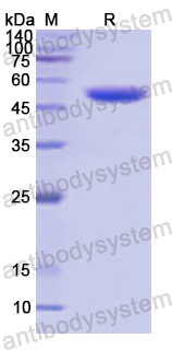 Recombinant Human ALDH3B1 Protein, N-His