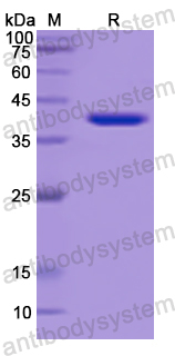 Recombinant Human NR4A2 Protein, N-His