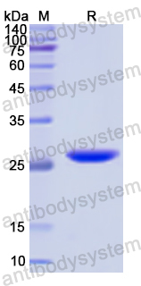 Recombinant Human MAGEA1 Protein, N-His