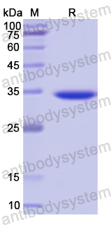 Recombinant Human MAGEA4 Protein, C-His