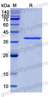 Recombinant Human MAGEA11 Protein, N-His