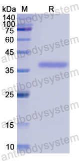 Recombinant Human PTPN9 Protein, N-His