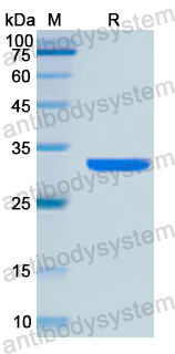 Recombinant Human ZAP70 Protein, N-His