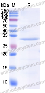 Recombinant Human SYK Protein, N-His