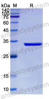 Recombinant Human CD158i/KIR2DS4 Protein, N-His