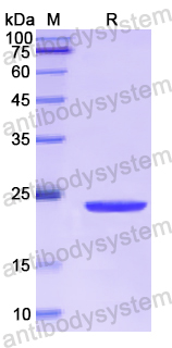 Recombinant Human AFM Protein, N-His