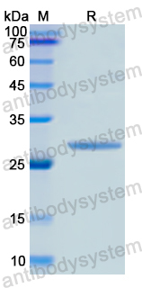 Recombinant Human GATA4 Protein, N-His