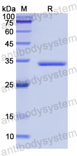 Recombinant Human NKX2-1 Protein, N-GST