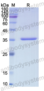 Recombinant Human MAPK8 Protein, N-His