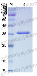 Recombinant Human MAPK9 Protein, N-His