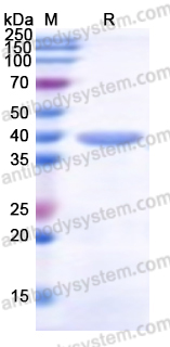 Recombinant Human MAP2K4 Protein, N-His