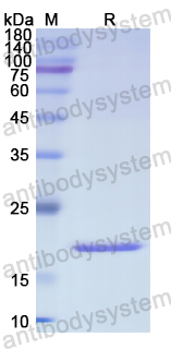 Recombinant Human Ki67/MKI67 Protein, N-His