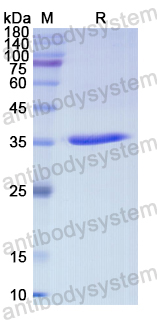 Recombinant Human CCR10 Protein, N-GST