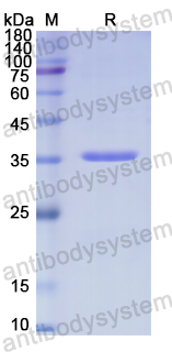 Recombinant Human CRKL Protein, N-His