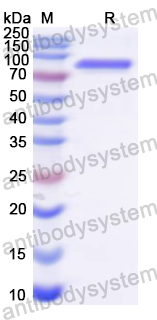 Recombinant Human NSF Protein, N-His