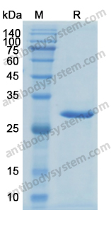 Recombinant Human CDKN1B Protein, N-His