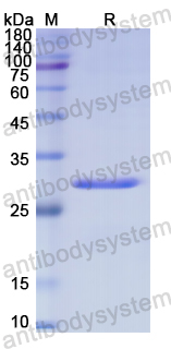 Recombinant Human MAP2K3 Protein, N-His