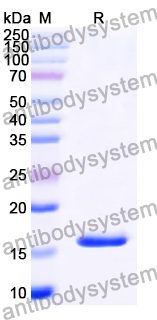 Recombinant Human RPL28 Protein, N-His